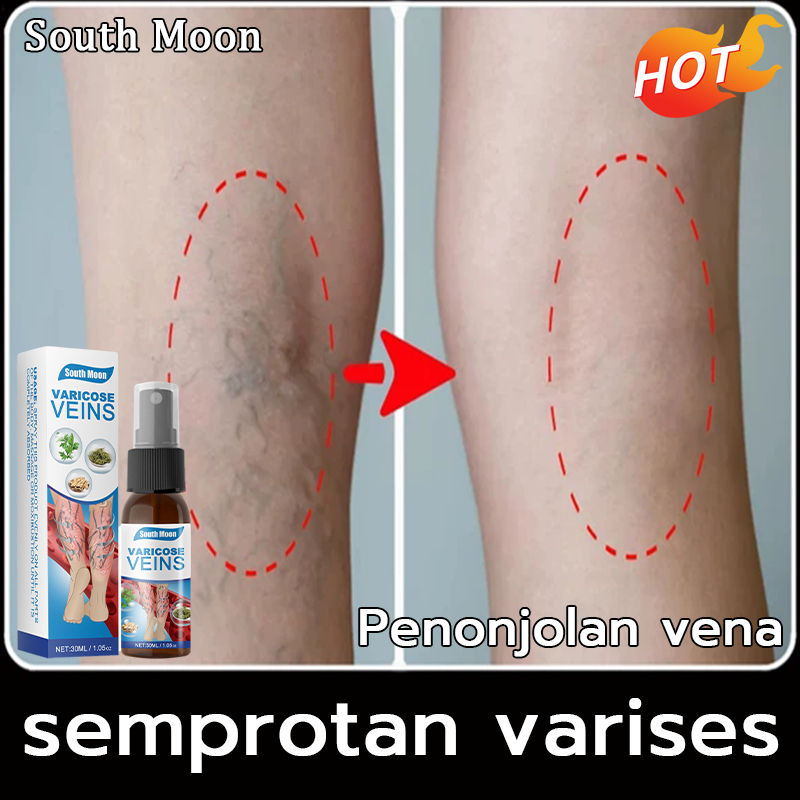 Jual Varicose Vein Sprayt Varises Salep Veins Varikokel Bengkak