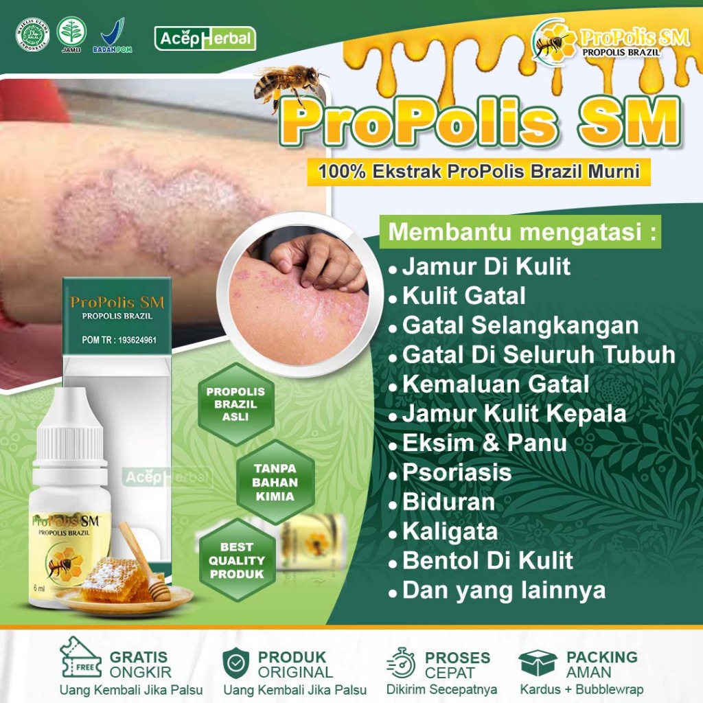 Jual Propolis Sm Obat Jamur Di Kulit Gatal Di Kulit Gatal Selangkangan