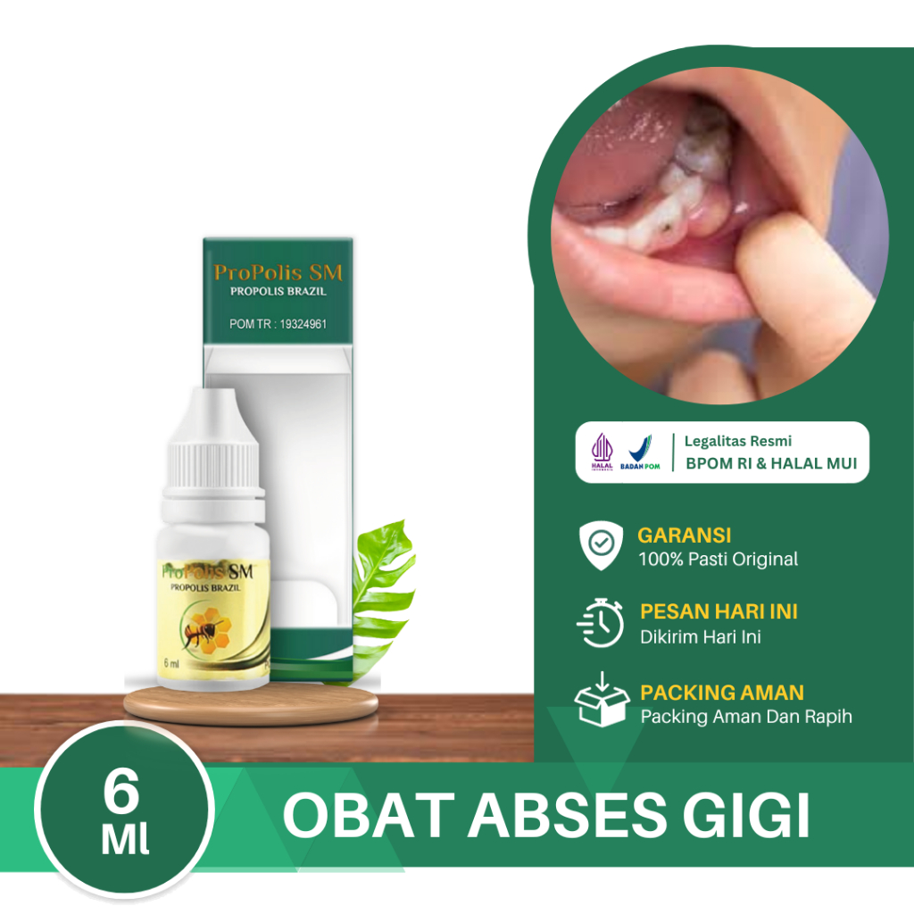 Jual Obat Abses Gigi Benjolan Di Gusi Benjolan Di Atas Gigi Benjolan