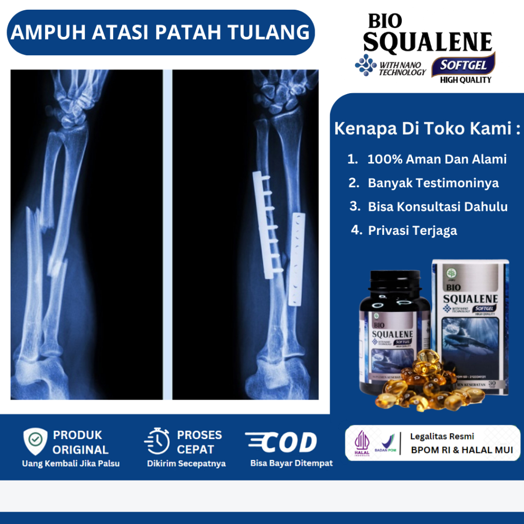 Jual Obat Patah Tulang Dan Retak Patah Tulang Tangan Kaki Tulang