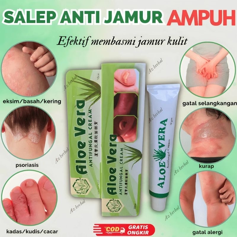 Jual Obat Gatal Kulit Kurap Kadas Ampuh Aloe Vera Obat Gatal Paling