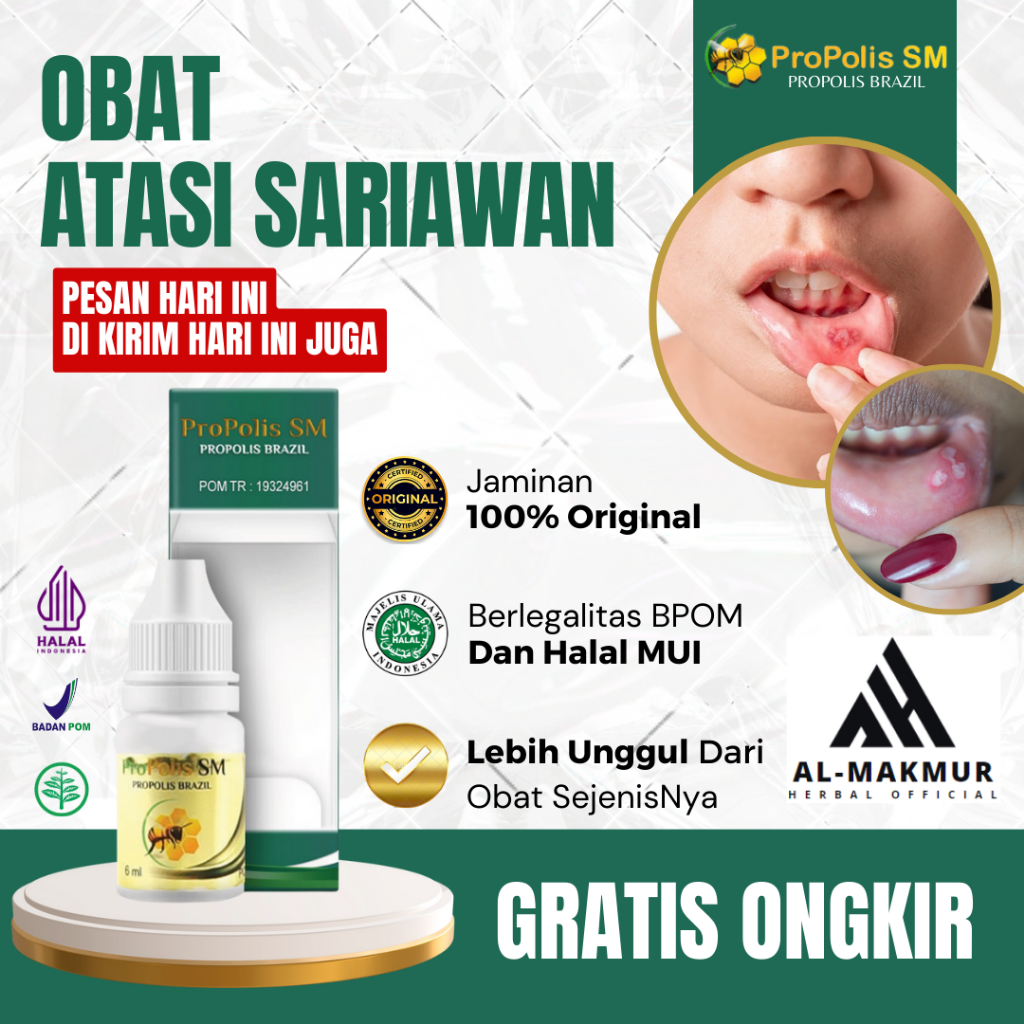 Jual Obat Tetes Sariawan Pinggir Bibir Obat Totoaeun Obat Sisi Bibir