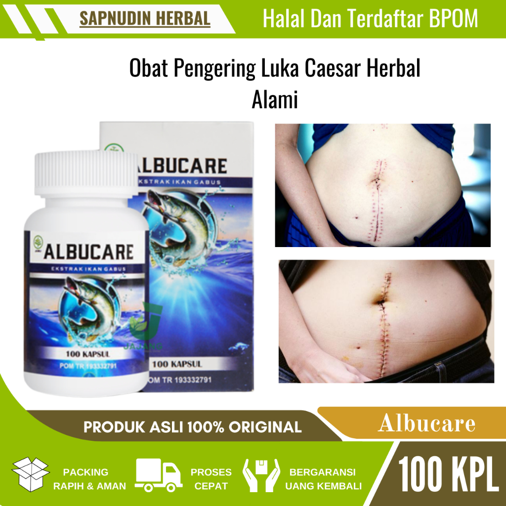 Jual Obat Pengering Luka Pasca Operasi Caesar Bekas Luka Jahitan Agar