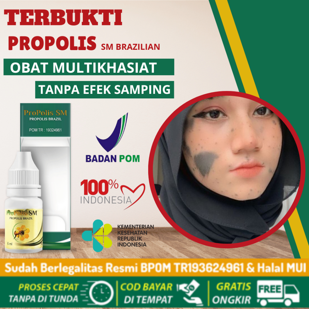 Jual Obat Penghilang Tanda Lahir 100 Alami Obat Penghilang Tanda