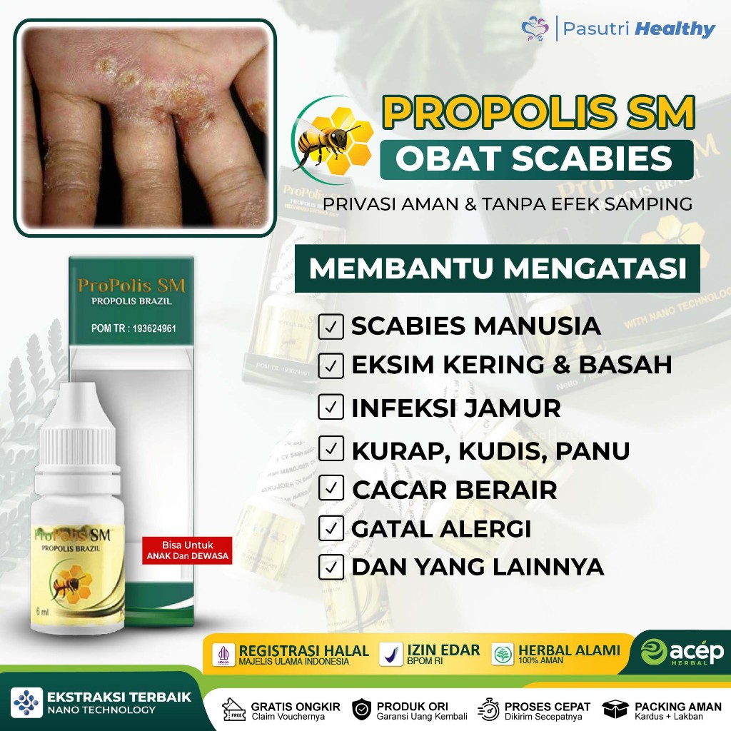 Jual Obat Herbal Scabies Manusia Budug Gudik Eksim Infeksi Jamur Kurap