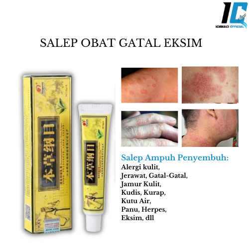 Jual Original Obat Gatal Eksim Kering Menahun Ampuh Salep Eksim Gatal