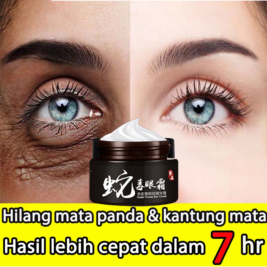 Jual Cream Mata Menghilangkan Mata Panda Penghilang Krim Kantung Mata