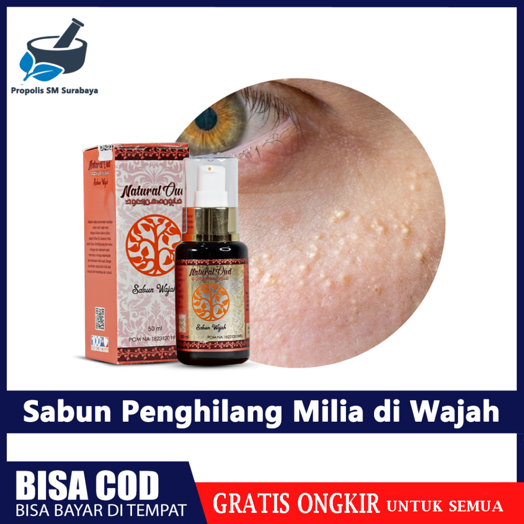 Jual Obat Penghilang Milia Bruntusan Bintik Putih Di Wajah Herbal Sabun