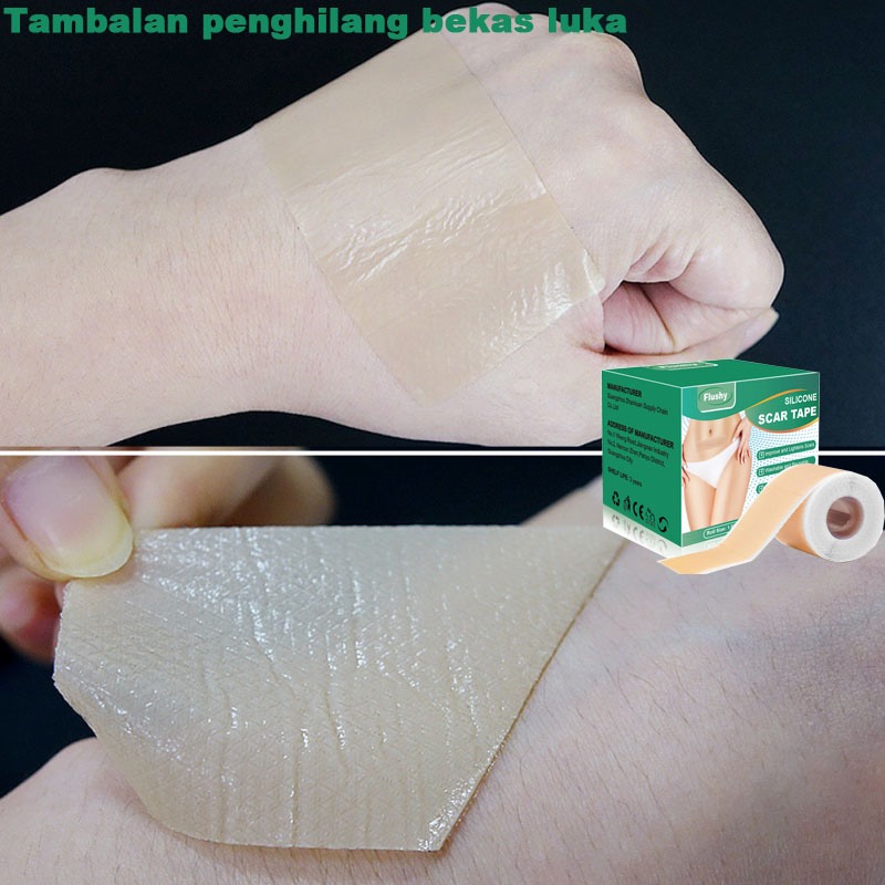 Jual Silicone Scar Sheet Penghilang Bekas Luka Menghilangkan Bekas Luka