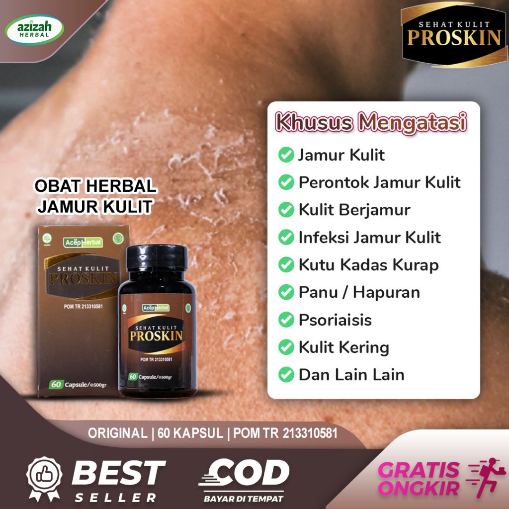 Jual Obat Jamur Kulit Panu Kadas Kurap Psoriasis Scabies Kusta Alergi