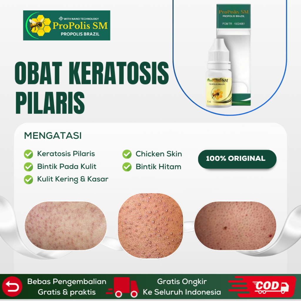 Jual Obat Keratosis Pilaris Obat Bintik Hitam Di Kulit Obat Kulit