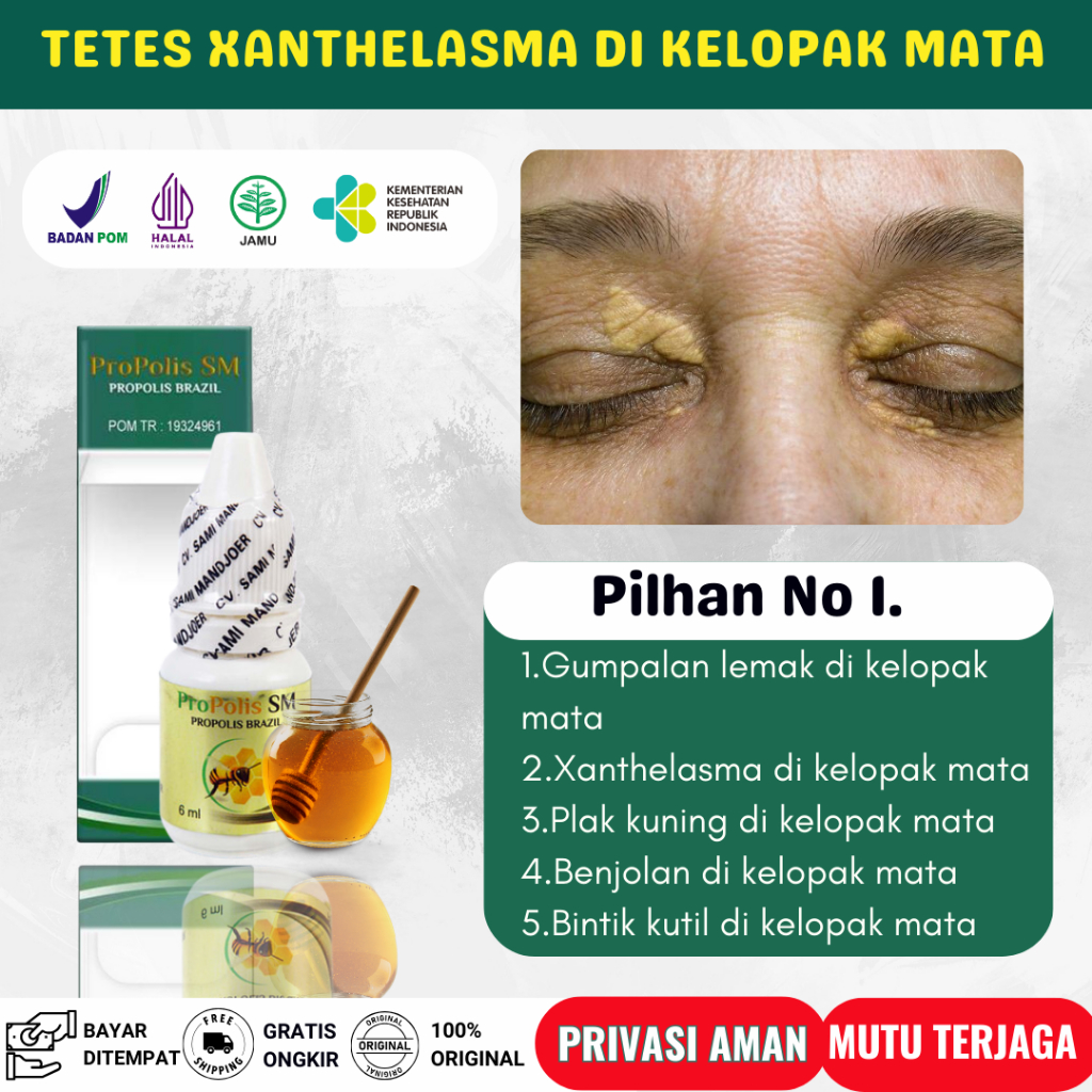 Jual Propolis Sm Obat Oles Penghilang Gumpalan Lemak Di Kelopak Mata