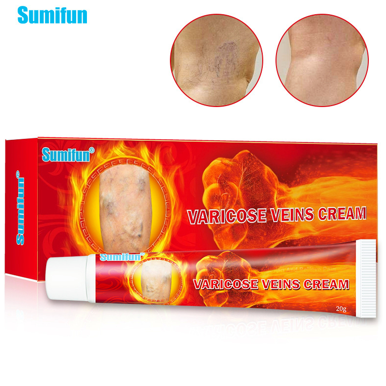 Jual SUMIFUN Varicose Vein Repair Cream Varicosity Relief Varicose