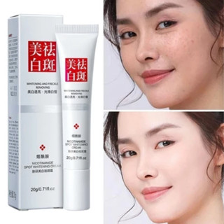 Jual Fuyan Whitening Freckle Cream Remove Dark Spots Anti Niacinamide