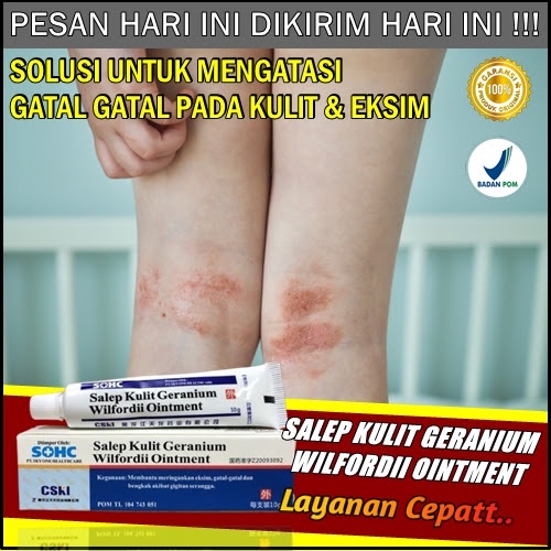 Jual Obat Salep Gatal Kulit Paling Ampuh Salep Geranium Shopee Indonesia