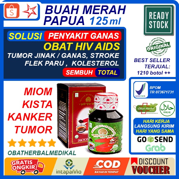 Jual Obat Hiv Aids Miom Kista Ovarium Kista Coklat Kista Endometriosis