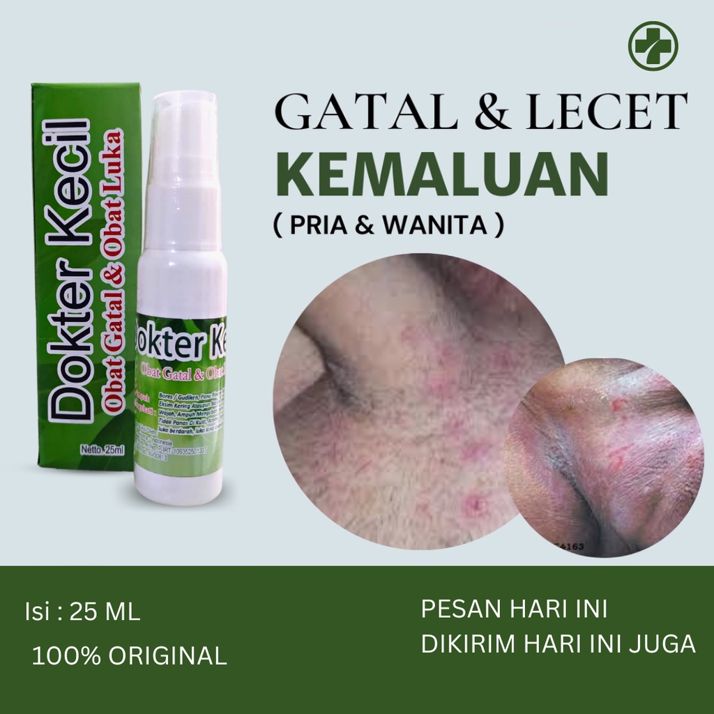 Jual Obat Gatal Selangkangan Eksim Dan Jamur Paling Ampuh 100 Herbal