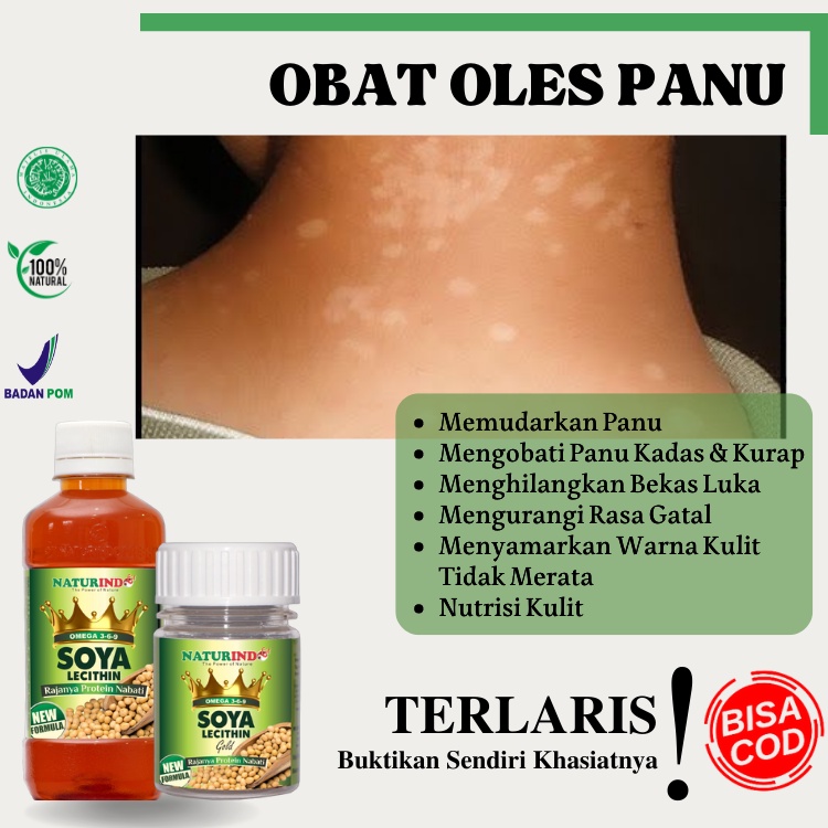 Jual Obat Panu Kadas Kurap Jamur Air Obat Penghilang Panu Bekas Luka