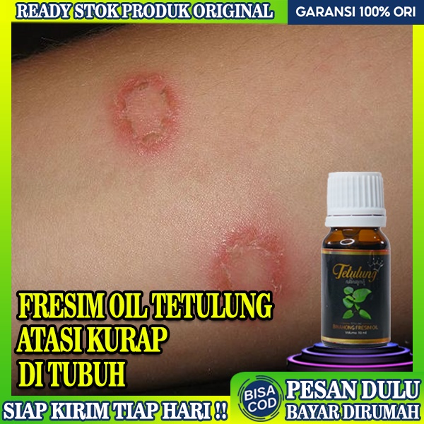 Jual Obat Oles Untuk Kurap Obat Kurap Di Badan Fresim Oil Tetulung