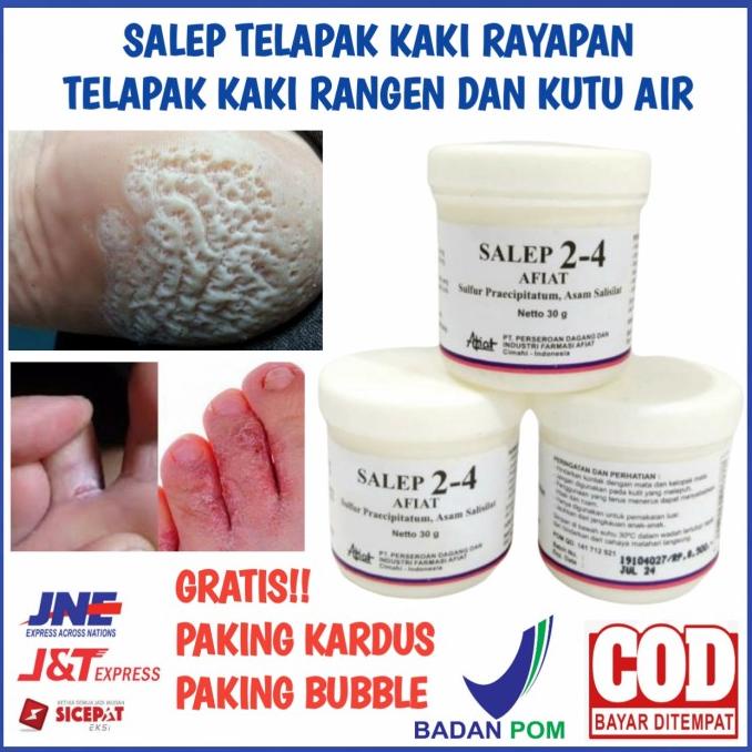 Jual Salep Telapak Kaki Rayapan Telapak Kaki Rangen Dan Kutu Air