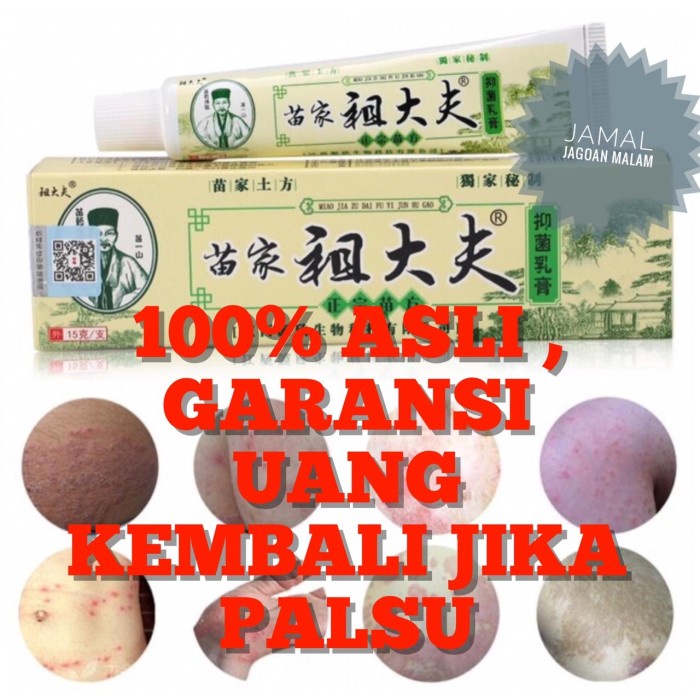 Jual Obat Salep Gatal Gatel Kulit Kurap Jamur Bakteri ZUDAIFU Herbal