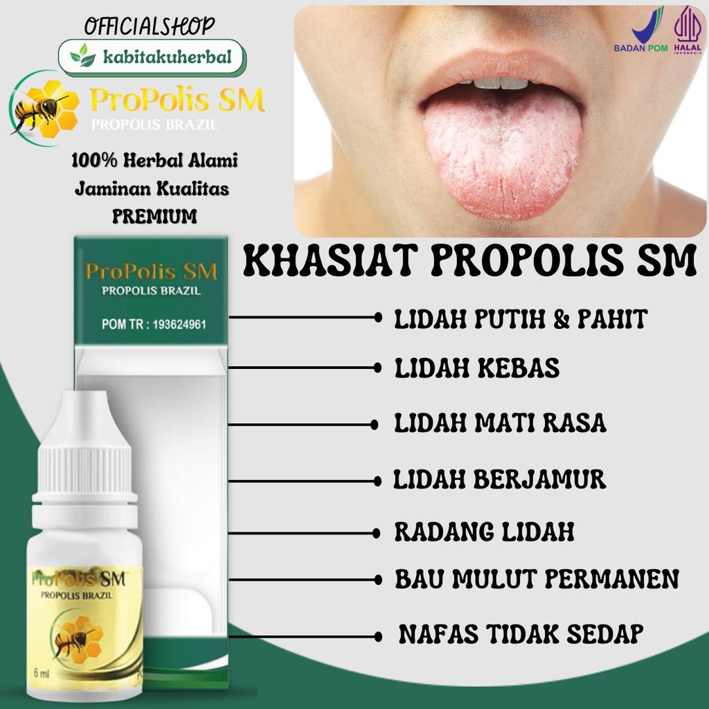 Jual Obat Lidah Putih Terasa Pahit Berjamur Lidah Mati Rasa Benjolan Di