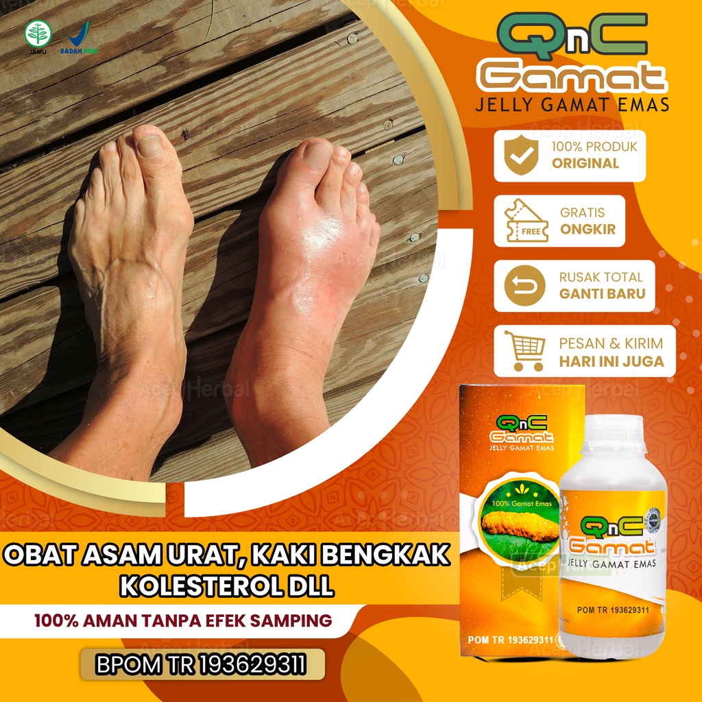 Jual Obat Asam Urat Dan Kolesterol Nyeri Sendi Tangan Kebas Kaki