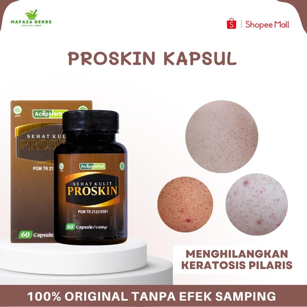 Jual Brands Festival Proskin Obat Keratosis Pilaris Bintik Hitam