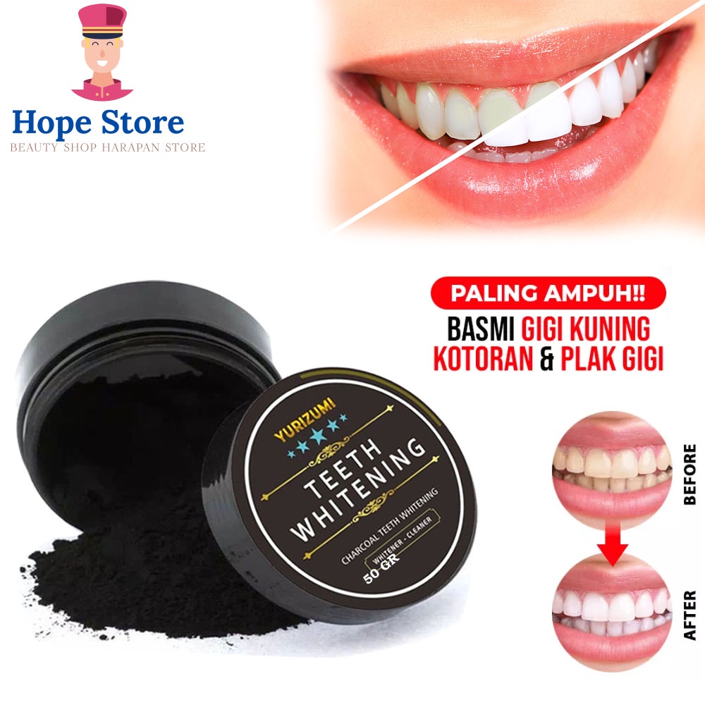 Jual Hope Store Pemutih Gigi Dan Penghilang Karang Gigi Instant