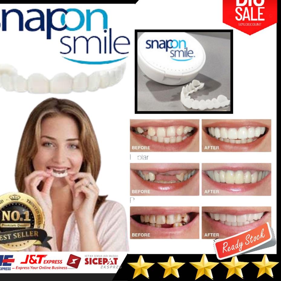 Jual Trendy Snap On Smile Gigi Palsu 1 SET ATAS BAWAH Shopee Indonesia