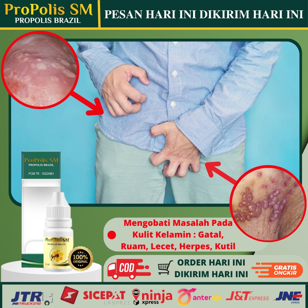 Jual Obat Salep Penis Gatal Obat Penis Lecet Perih Obat Salep Penis