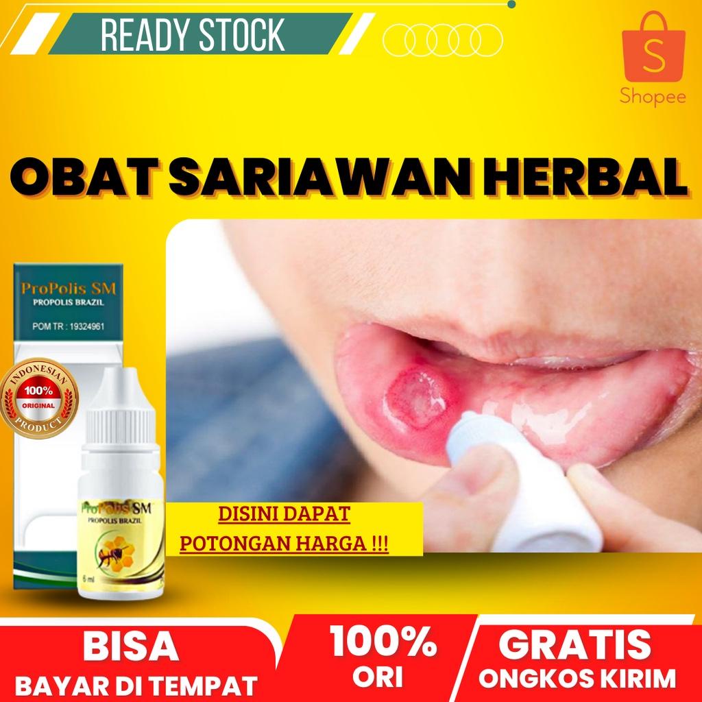 Jual OBAT TETES SARIAWAN DI BIBIR OBAT SARIAWAN MULUT OBAT SARIAWAN