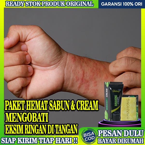 Jual Obat Eksim Gatal Kering Dan Basah Paket Hemat Sabun Binahong Dan