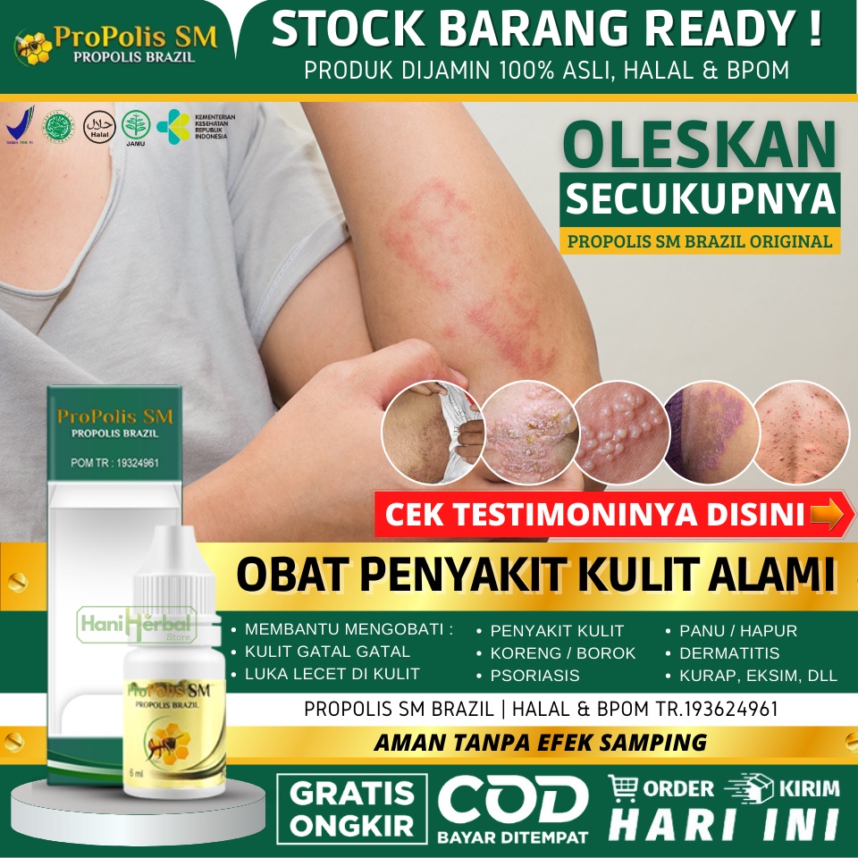 Jual Obat Untuk Menghilangkan Hapur Yang Alami Penghilang Hapur