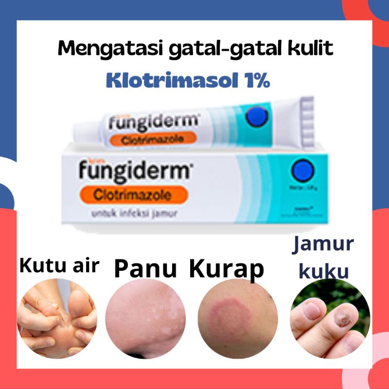 Jual Fungiderm G Krim Jamur Gatal Kulit Shopee Indonesia