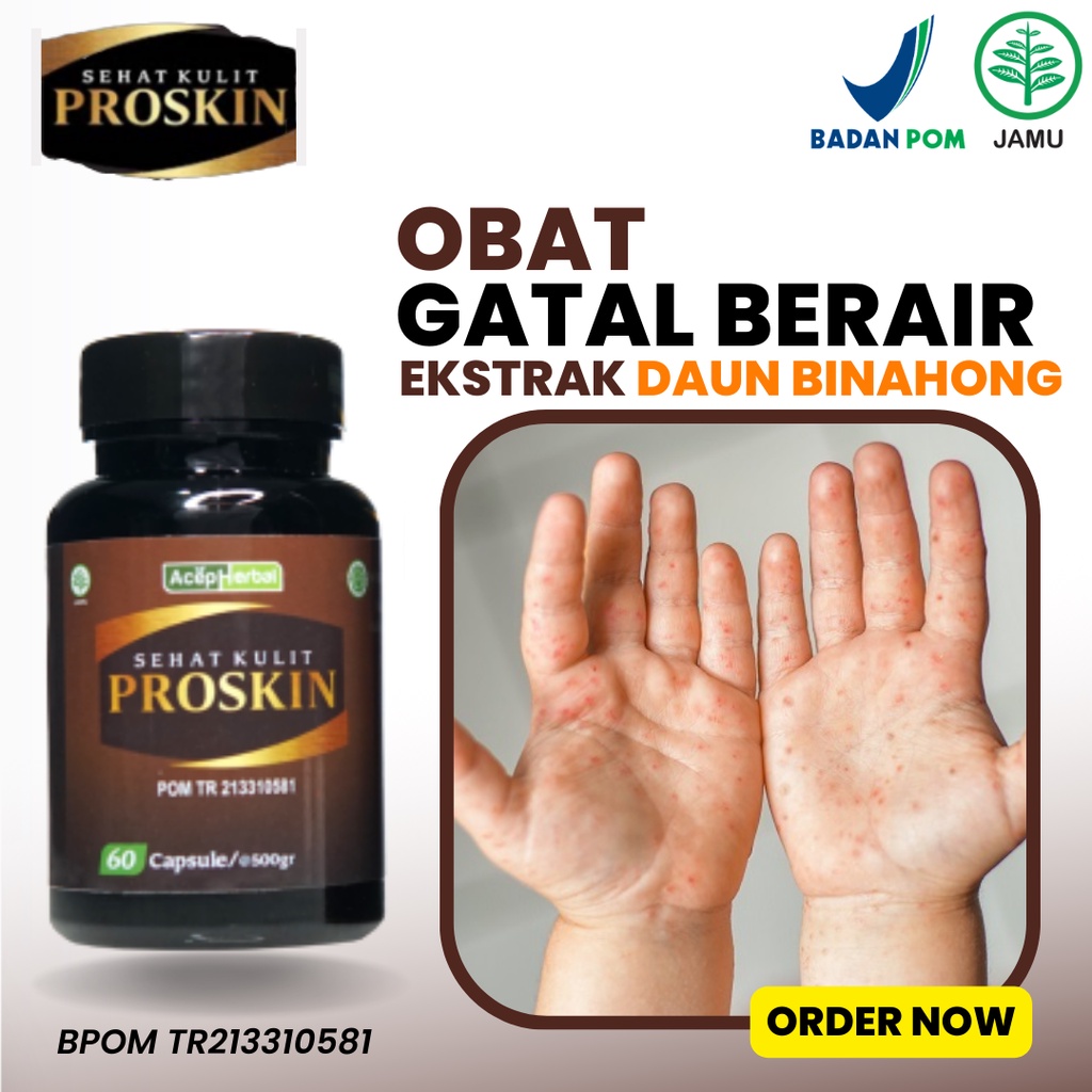 Jual Obat Gatal Berair Di Tangan Sela Jari Kaki Gatal Kutu Air