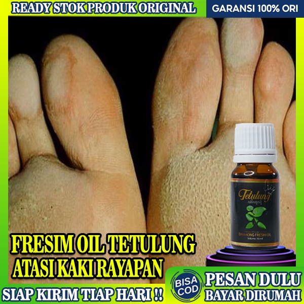 Jual Obat Telapak Kaki Bolong Bolong Dan Bau Obat Kaki Rayapan Kutu Air