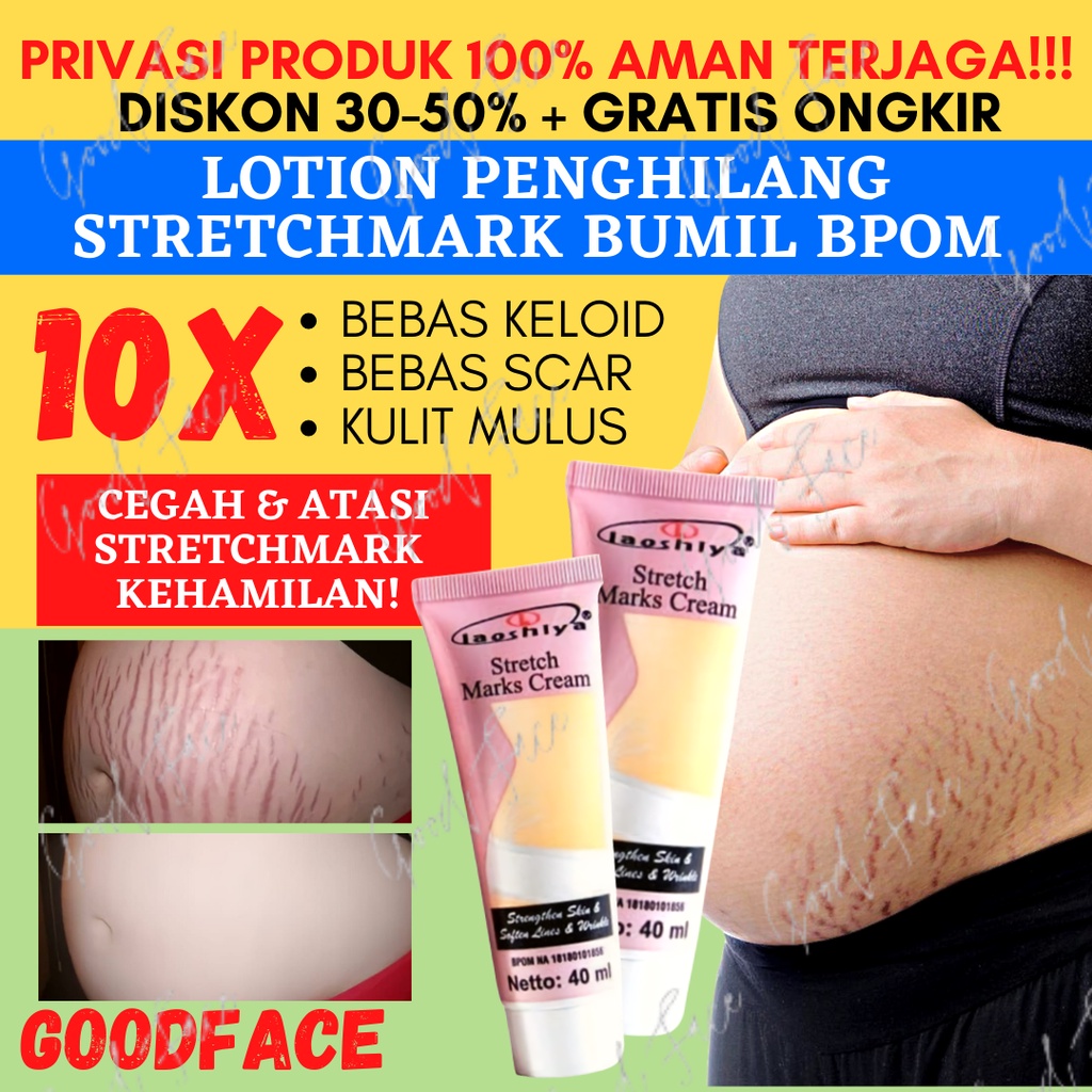 Jual Laoshiya Stretch Marks Cream Penghilang Strechmark Original Bpom