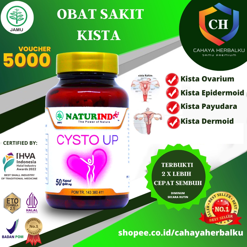 Jual Obat Miom Kista Ovarium Kista Coklat Kista Endometriosis Herbal