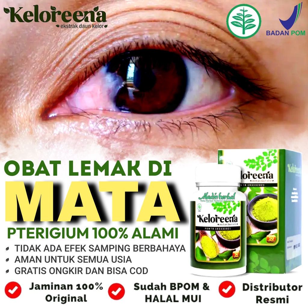 Jual Obat Mata Berlemak Pterigium Mata Katarak Mata Minus Rabun