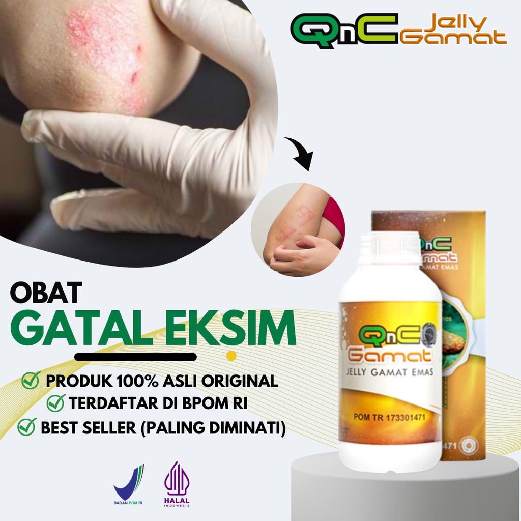 Jual Obat Eksim Kering Dan Basah Menahun Gatal Lecet Dan Berkerak Qnc