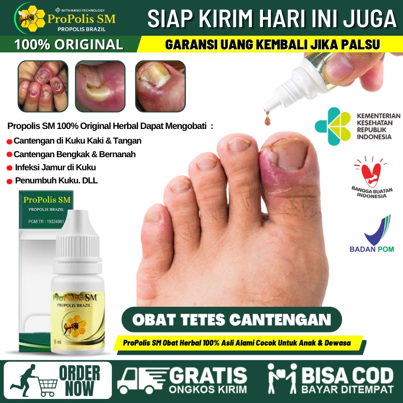 Jual Obat Tetes Cantengan Jempol Kaki Tangan Obat Kuku Jempol Kaki