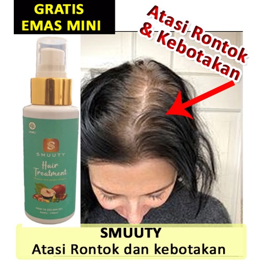 Jual Smuuty Hair Treatmen Untuk Rambut Rontok Parah Dan Kebotakan