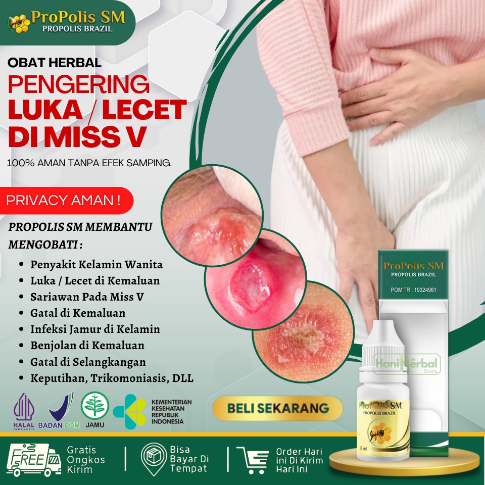 Jual Ready Obat Luka Di Vagina Miss V Lecet Vagina Lecet Miss V