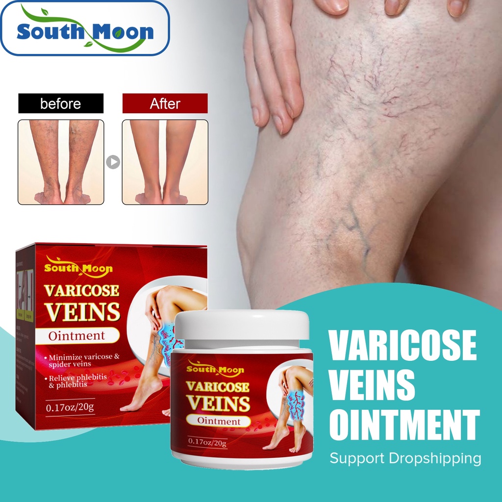 Jual Preorder South Moon Varicose Vein Repair Cream Treatment