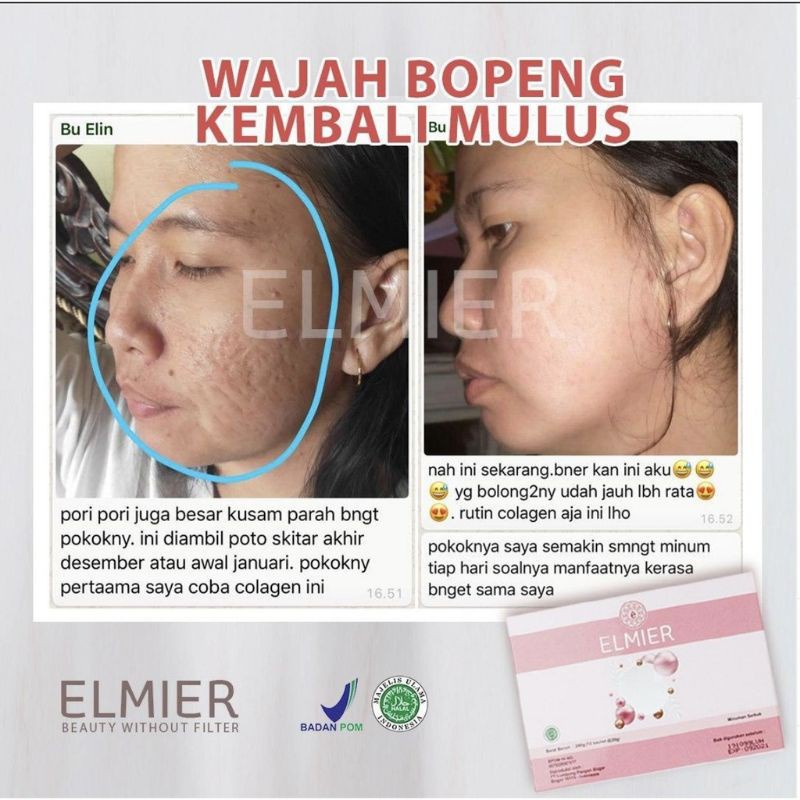 Jual ELMIER COLLAGEN KOLAGEN ANTI AGING NO SUGAR Premium Drink Grade