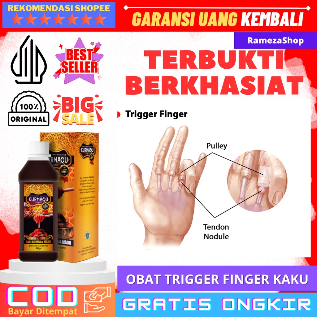 Jual Obat Trigger Finger Kaku Jari Pelatuk Jari Tangan Kaku Dan