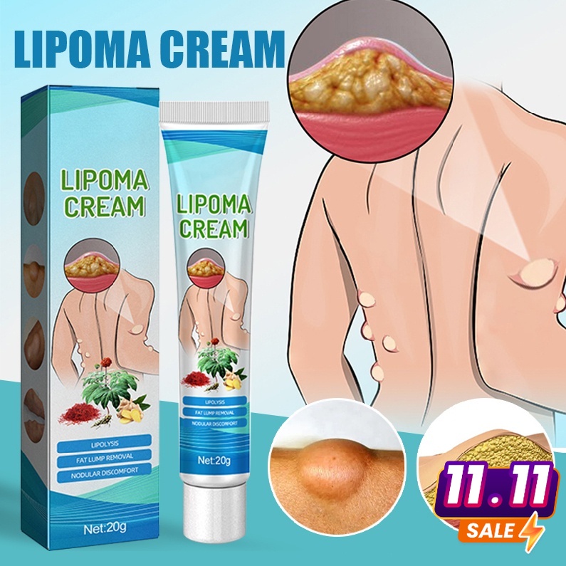 Jual Southmoon Lipoma Cream Original Obat Benjolan Obat Benjolan Lipoma