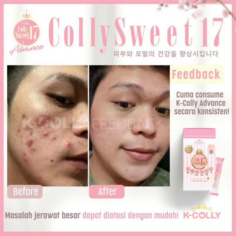 Jual ORIGINAL READY KCOLLY sweet 17 Tabung 830gram | Shopee Indonesia