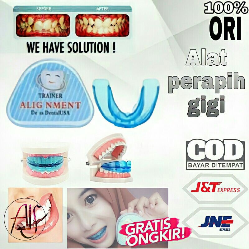 Jual ALAT PERAPIH DAN PERATA GIGI ORTHODONTIC TEETH TRAINER ALIGMENT ...